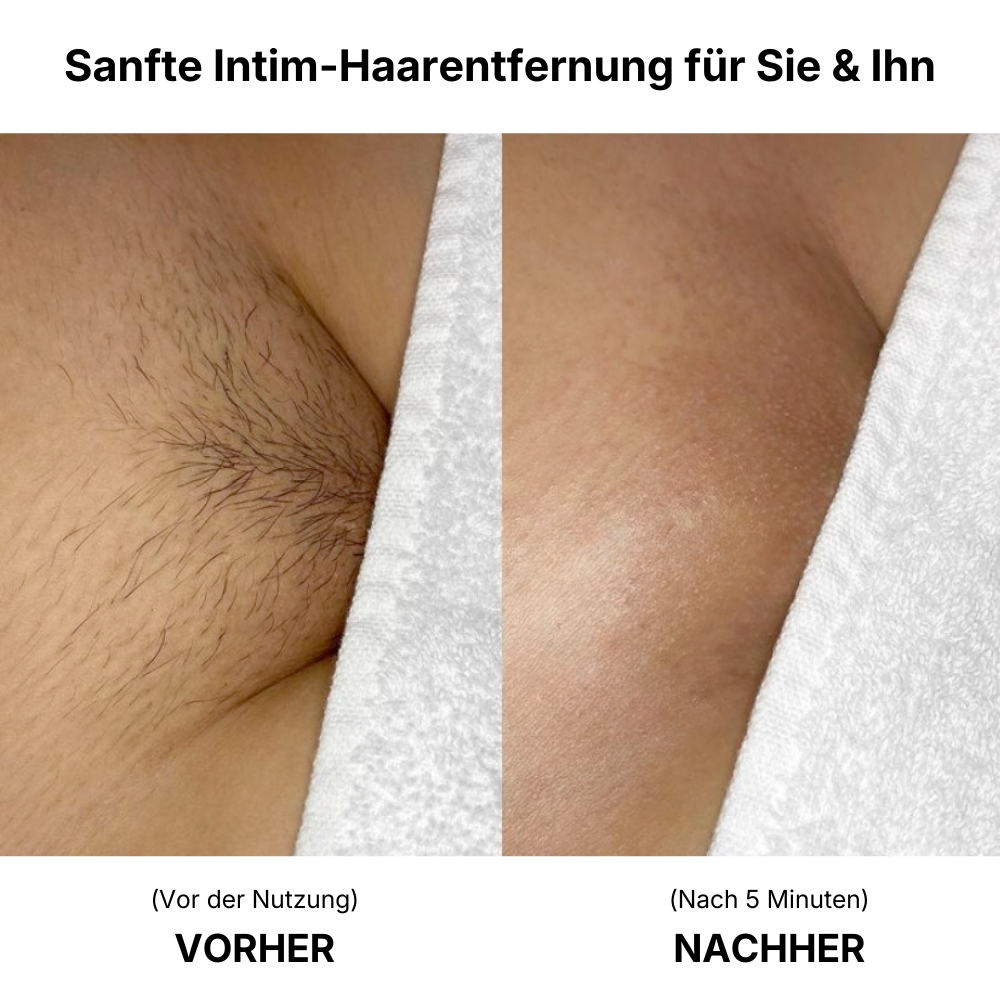 VEESH - Haarentfernungs Bundle