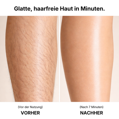 VEESH - Haarentfernungs Bundle